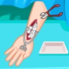 Princess Anna Arm Surgery